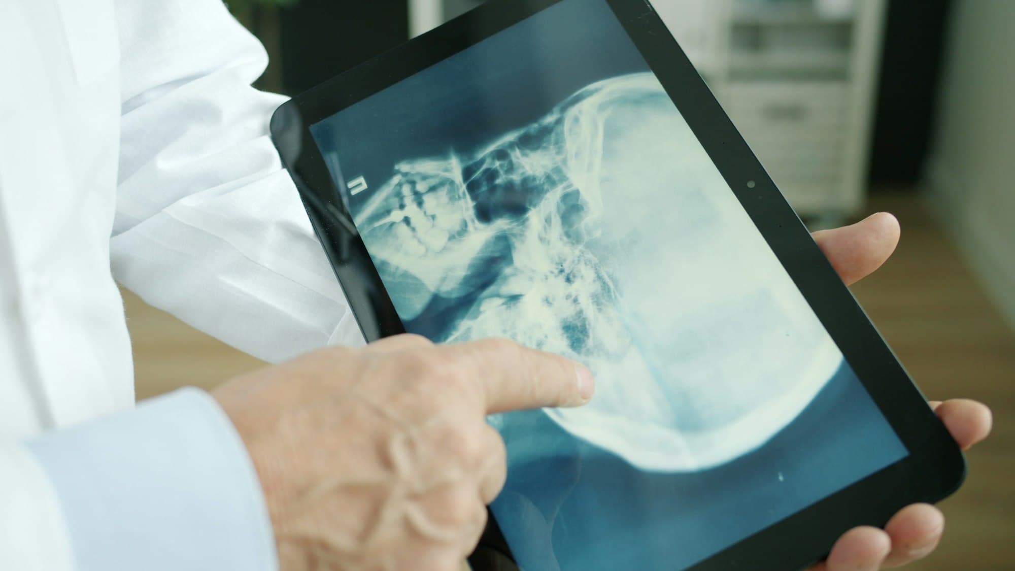 Clinician reviewing an X-ray on a tablet